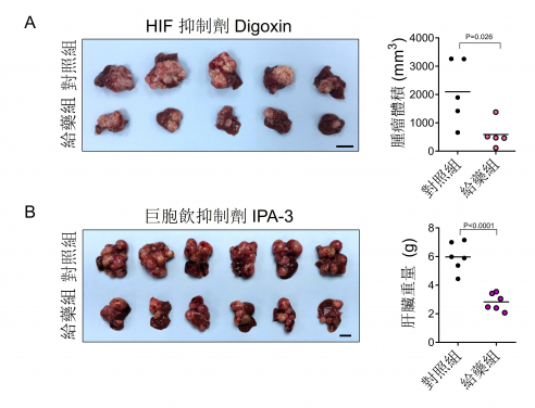 HKUMed discovers a new metabolic route for liver cancer  paving the way for new therapeutic opportunities 